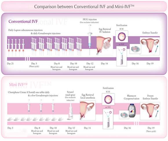 Things You Need To Know About Mini IVF Things You Need To Know About Mini IVF