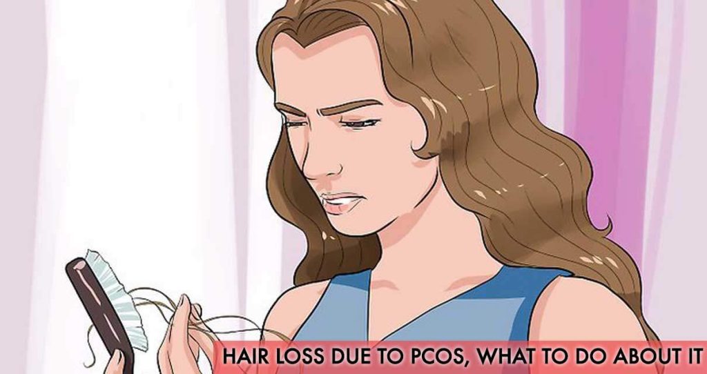 Hair Loss Due to PCOS, What to Do about It?