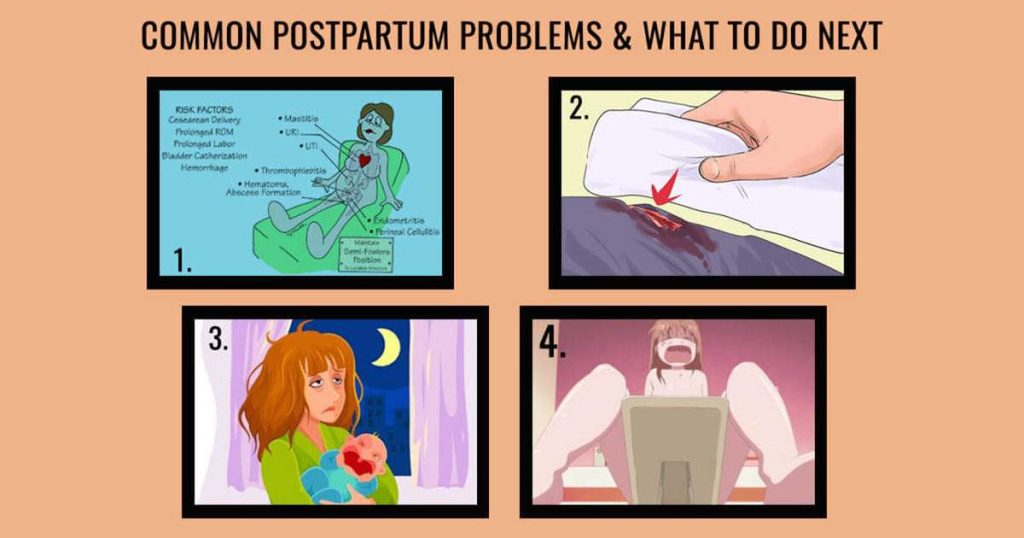 Common Postpartum Problems & What to do next