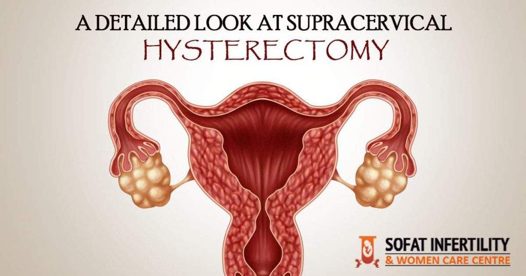 A detailed look at Supracervical hysterectomy