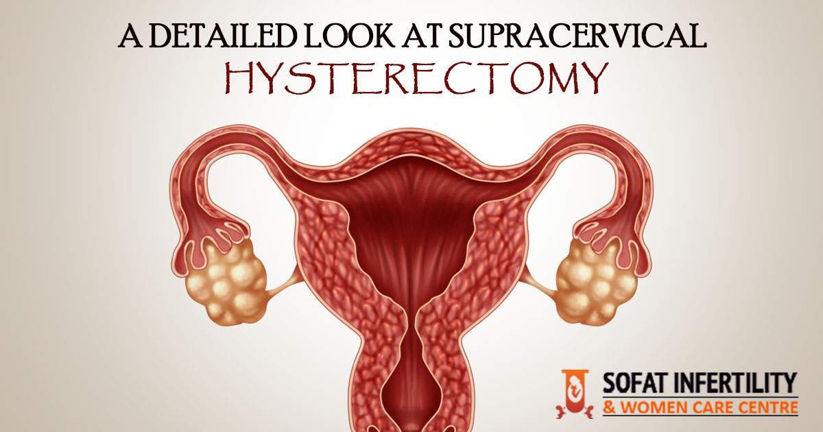 A Detailed Look At Supracervical Hysterectomy