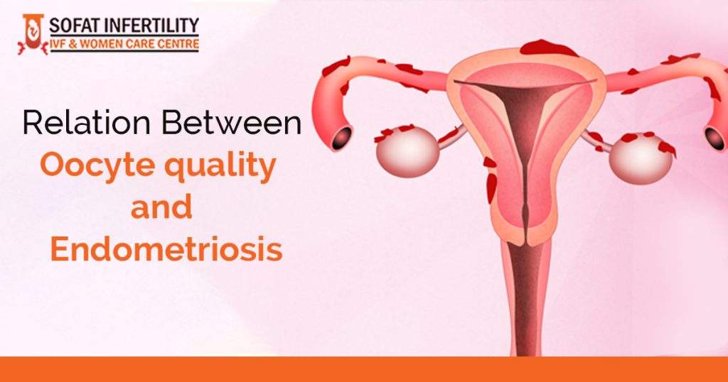 Relation between Oocyte quality and Endometriosis