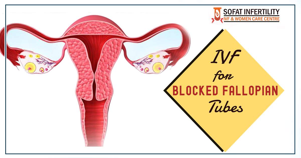 IVF for blocked fallopian tubes