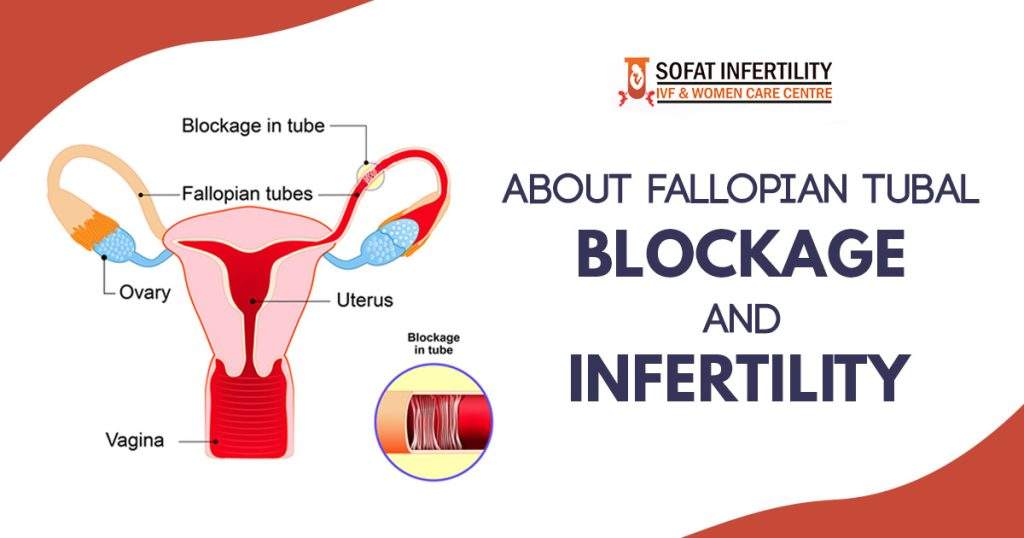 About fallopian tubal blockage and infertility