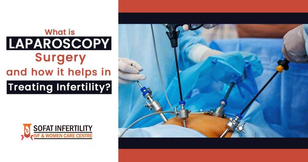 What is Laparoscopy surgery and how it helps in treating infertility