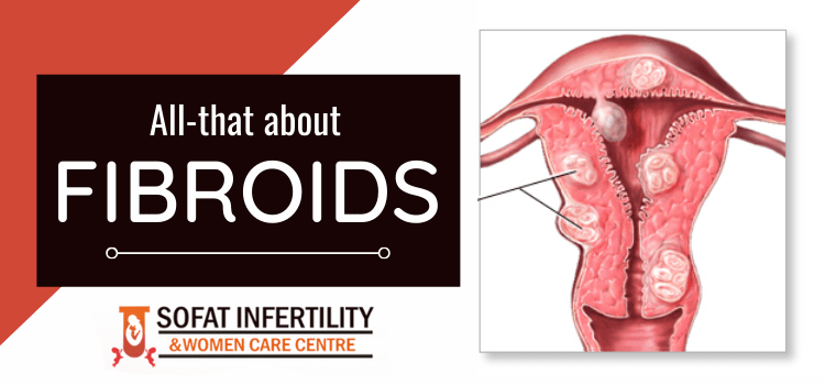 All-that about fibroids
