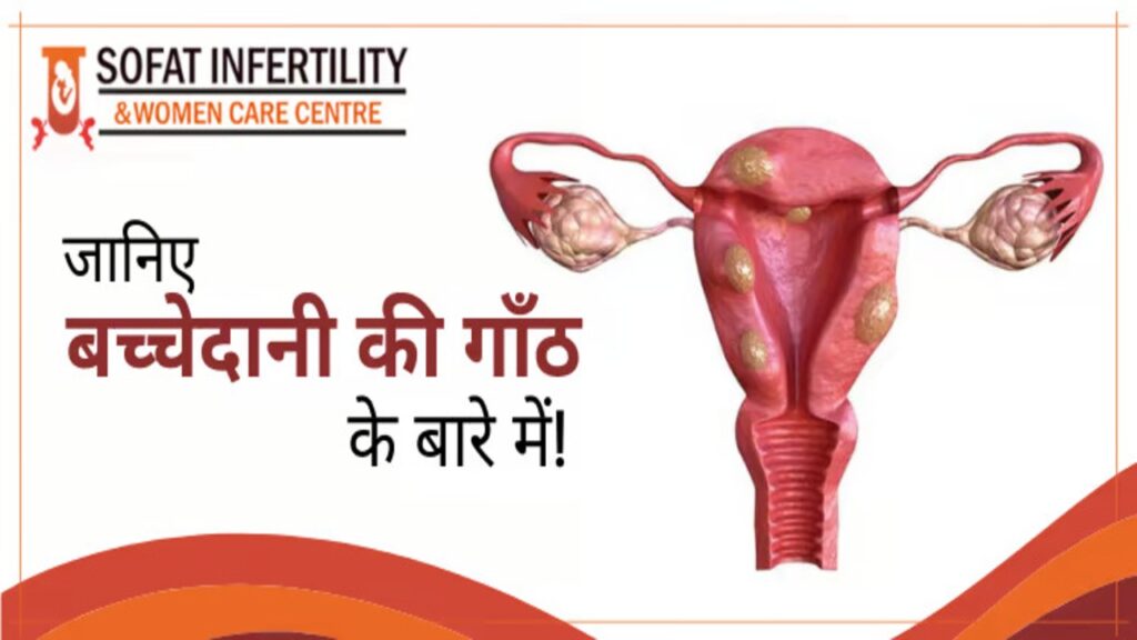 जानिए बच्चेदानी की गाँठ के बारे में!