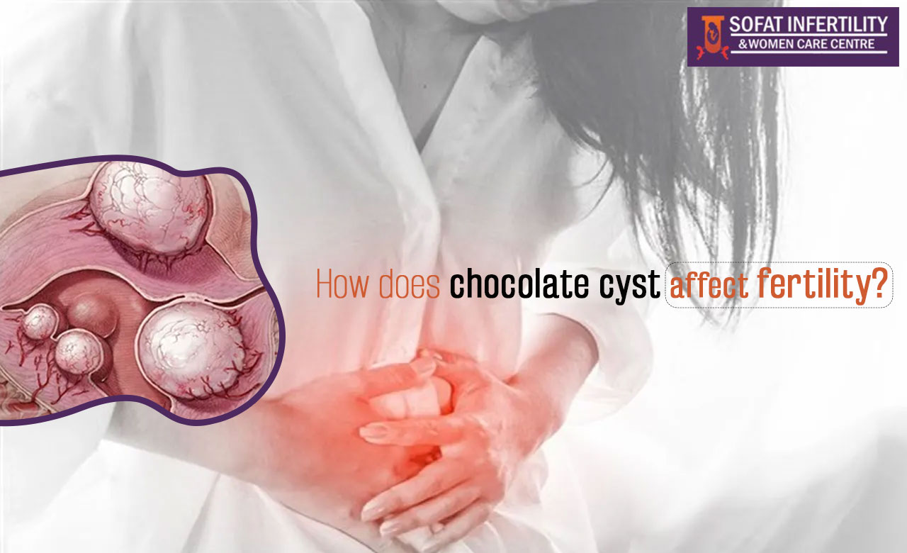 Comprehensive note on the chocolate cyst Dr. Sumita Sofat IVF Hospital Blog