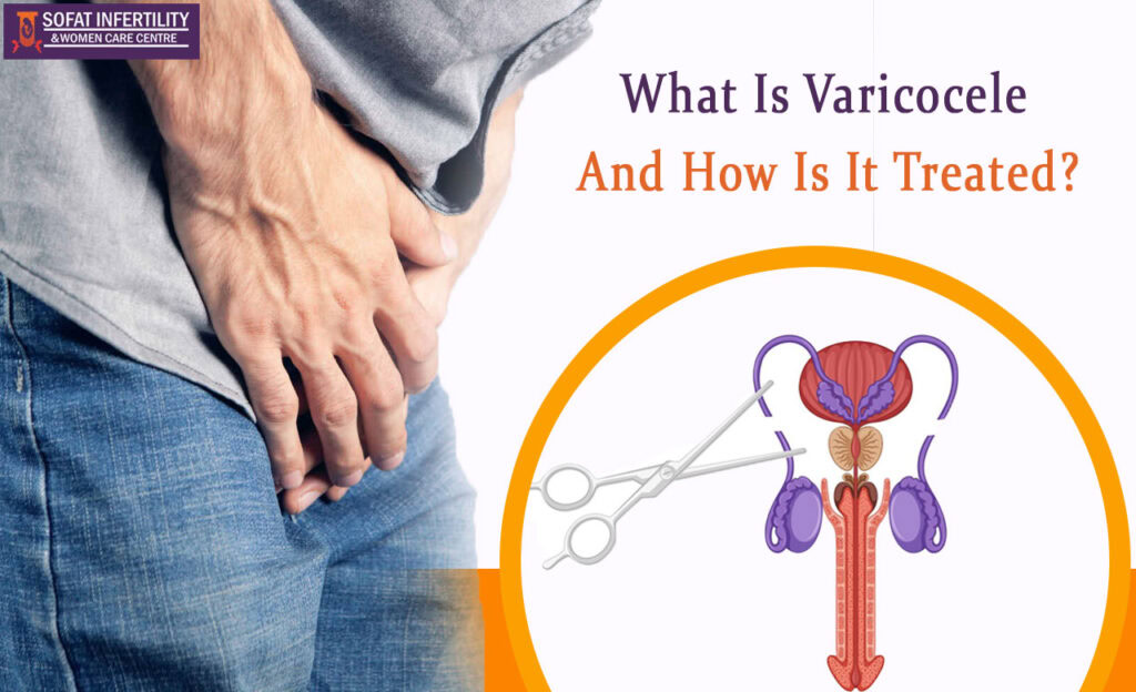 What Is Varicocele And How Is It Treated?