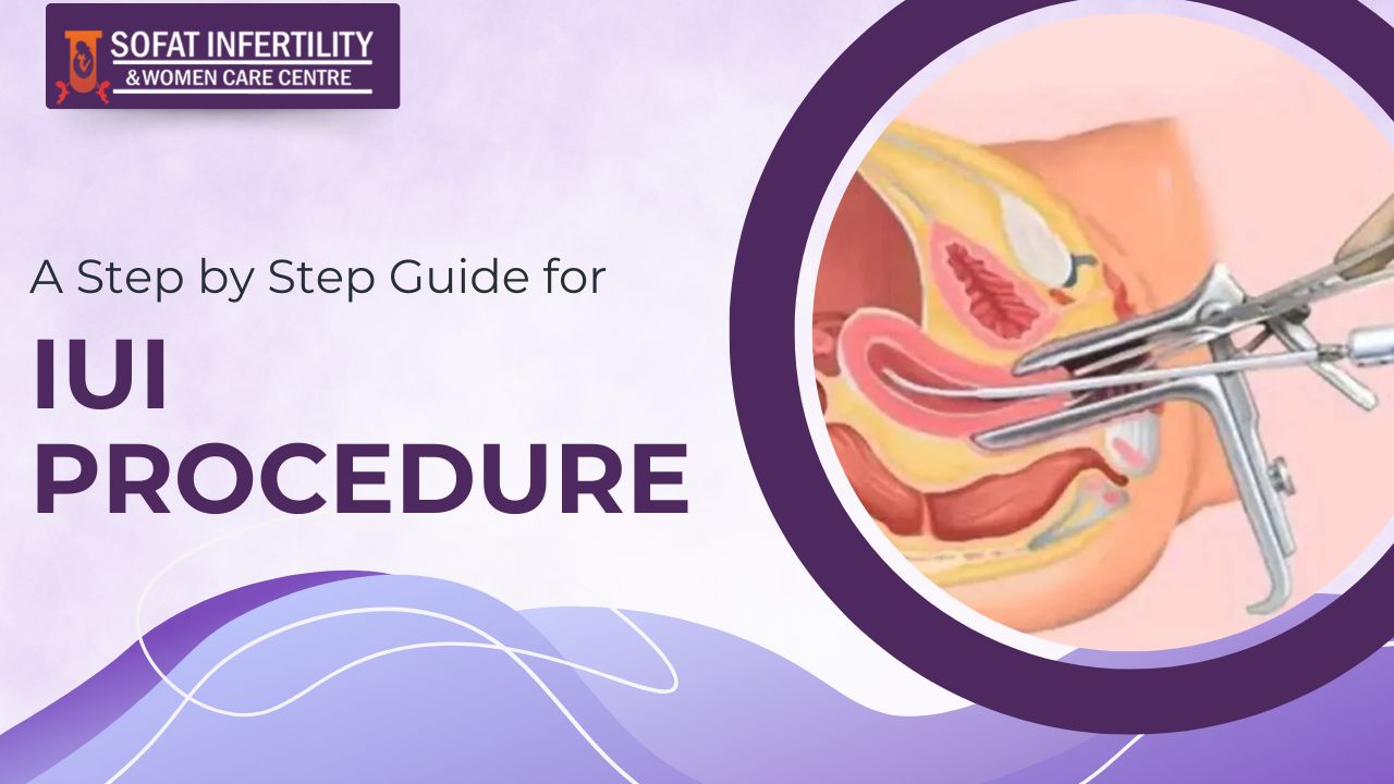 A Step by Step Guide for IUI Procedure