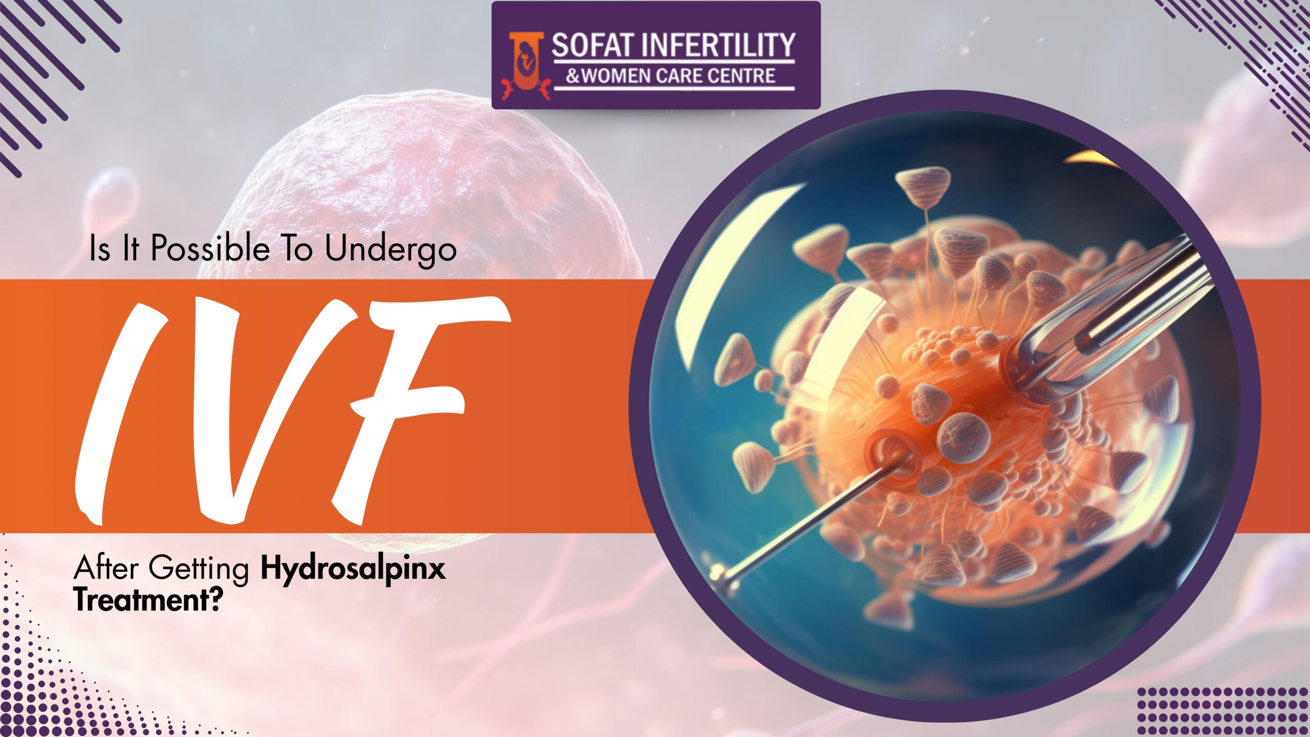 Is It Possible To Undergo IVF After Getting Hydrosalpinx Treatment?