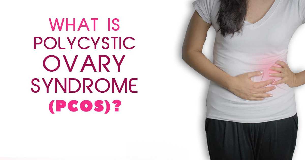 What is Polycystic Ovary Syndrome PCOS