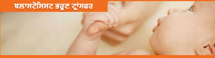 Blastocyst-Embryo-Transfer