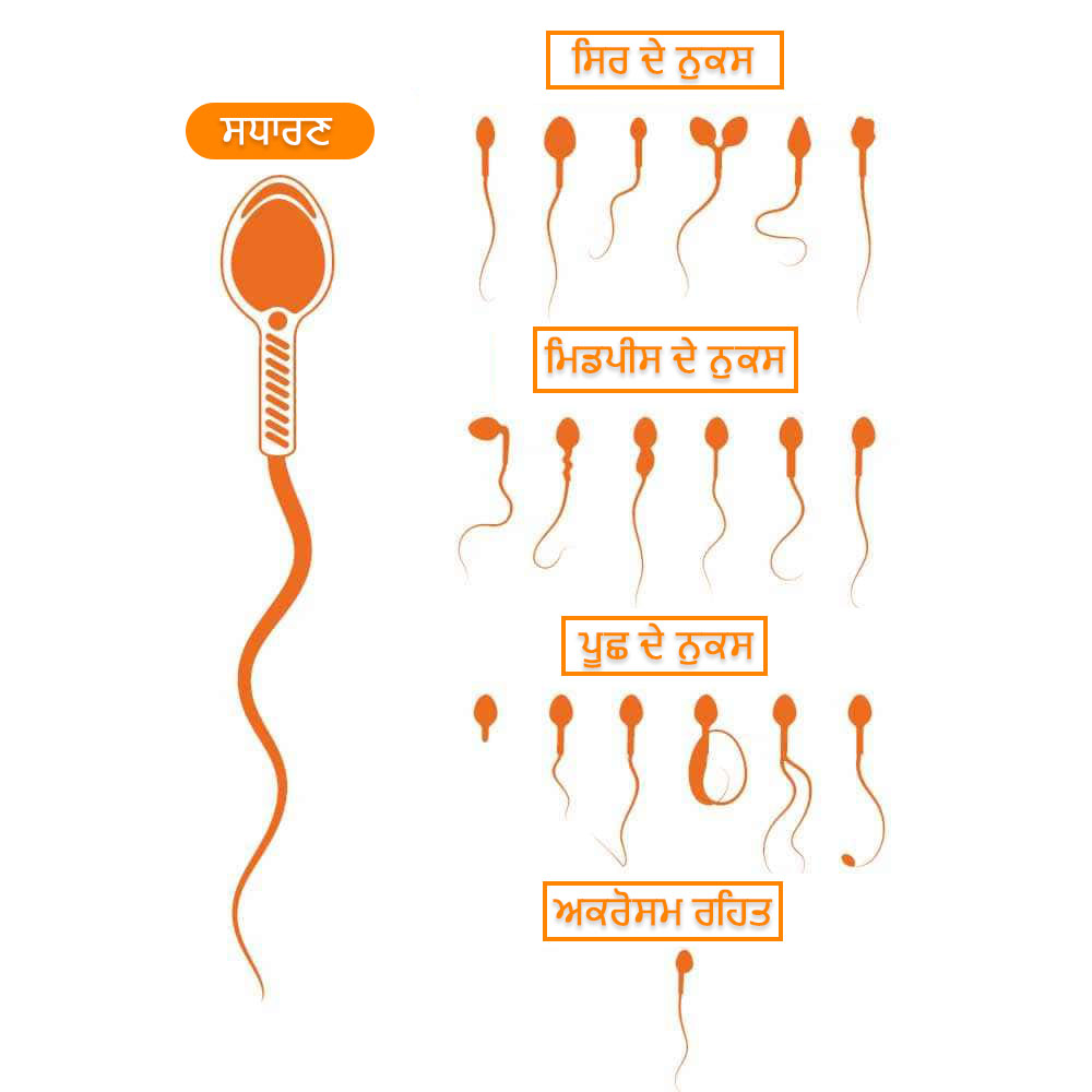 Sperm Morphology Defects