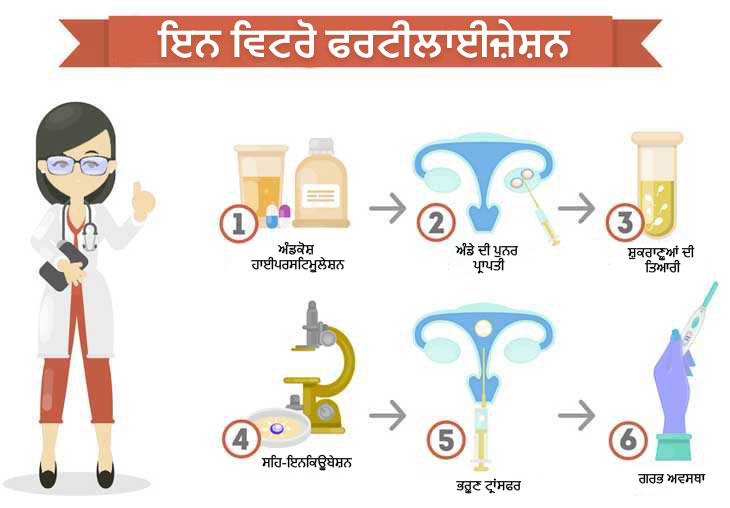 step to step ivf process