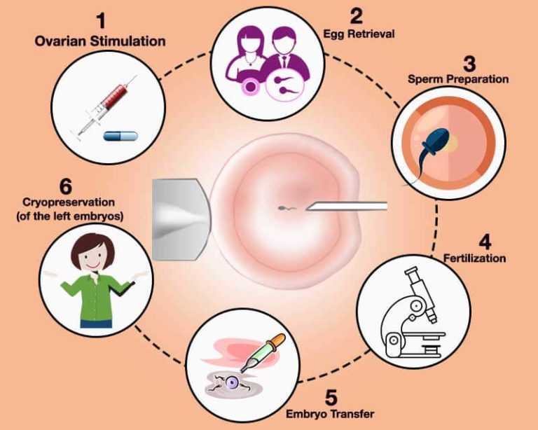 Best Icsi Treatment Centre In Punjab Icsi Treatment Cost In Ludhiana 6772