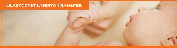 Blastocyst-Embryo-Transfer in India