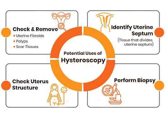 Potential-Uses-of-Hysteroscopy