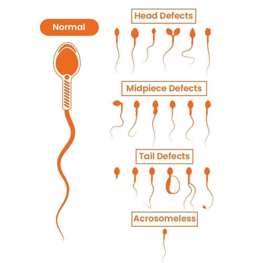 Sperm-Morphology-Defects-graphic1-jpg